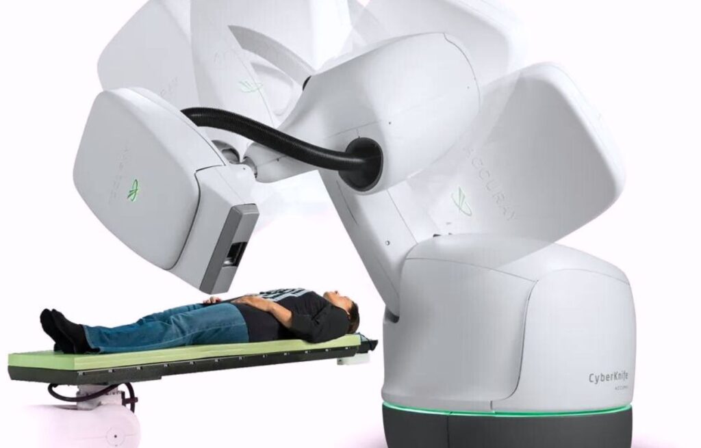 CyberKnife Treatment