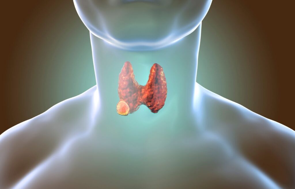 Thyroidectomy