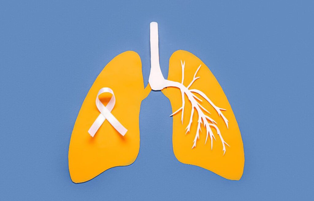 Lung Cancer Vaccine