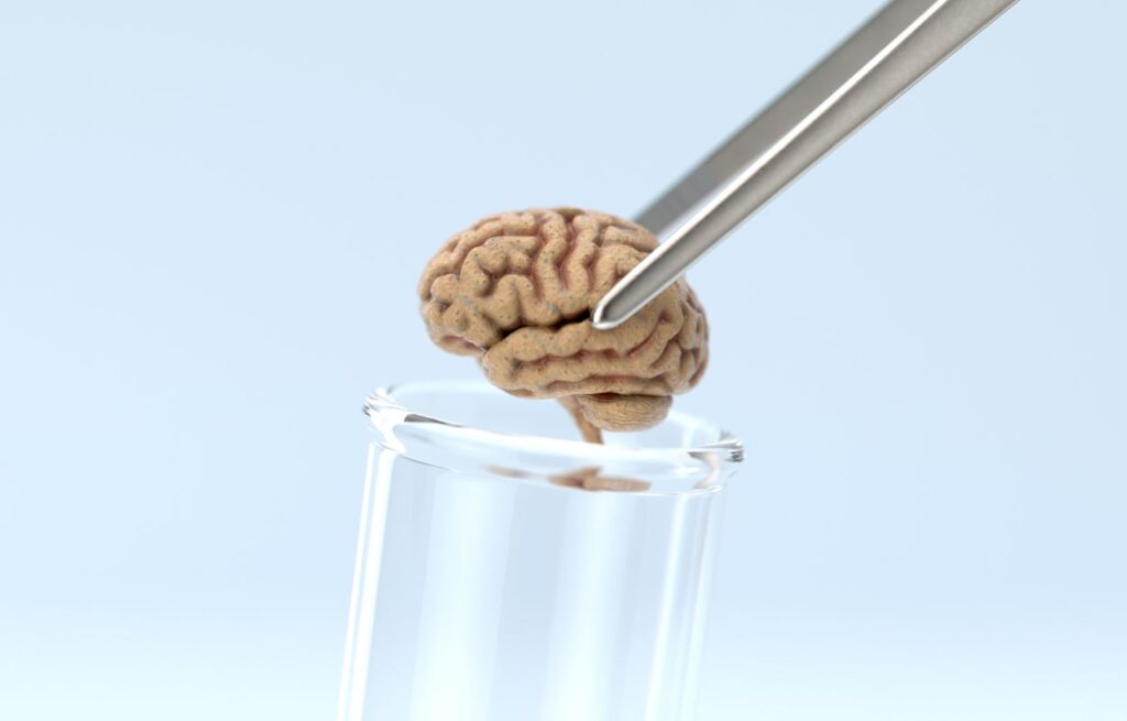Stereotactic Brain Biopsy