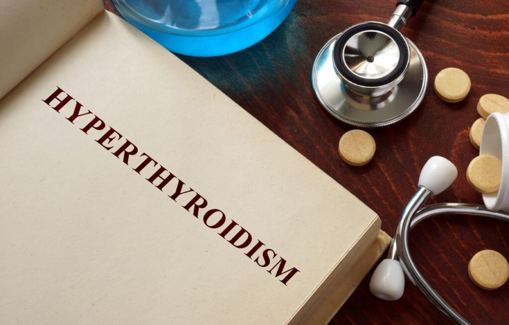 Hyperthyroidism