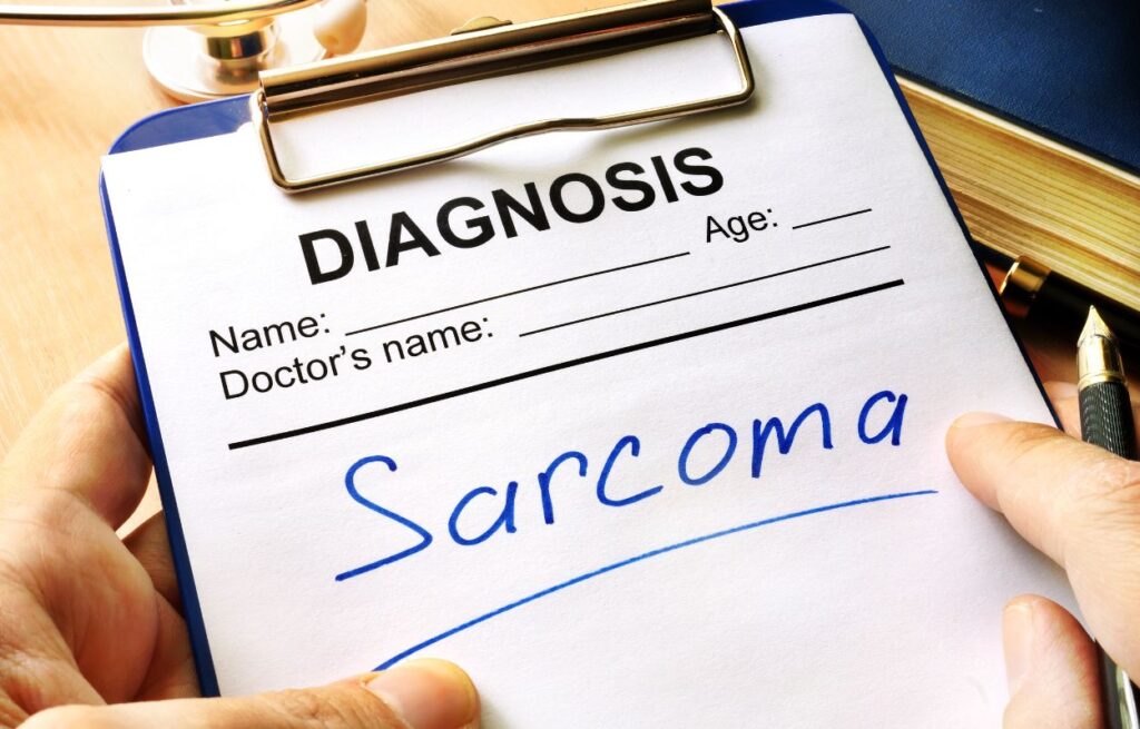 Synovial Sarcoma
