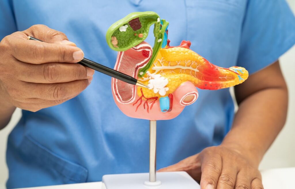 The Whipple Procedure
