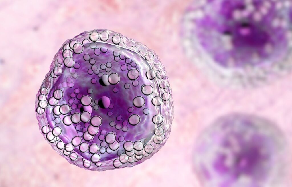 Non-Hodgkin Lymphoma
